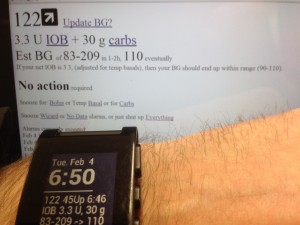 DIYPS prototype with Pebble