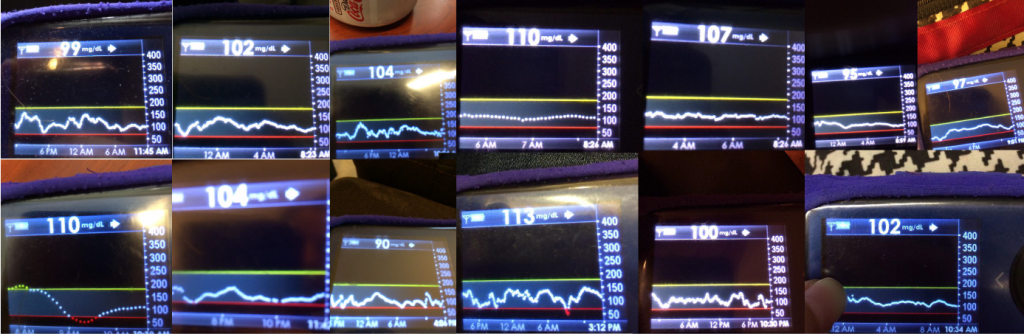 Dana BGs with OpenAPS