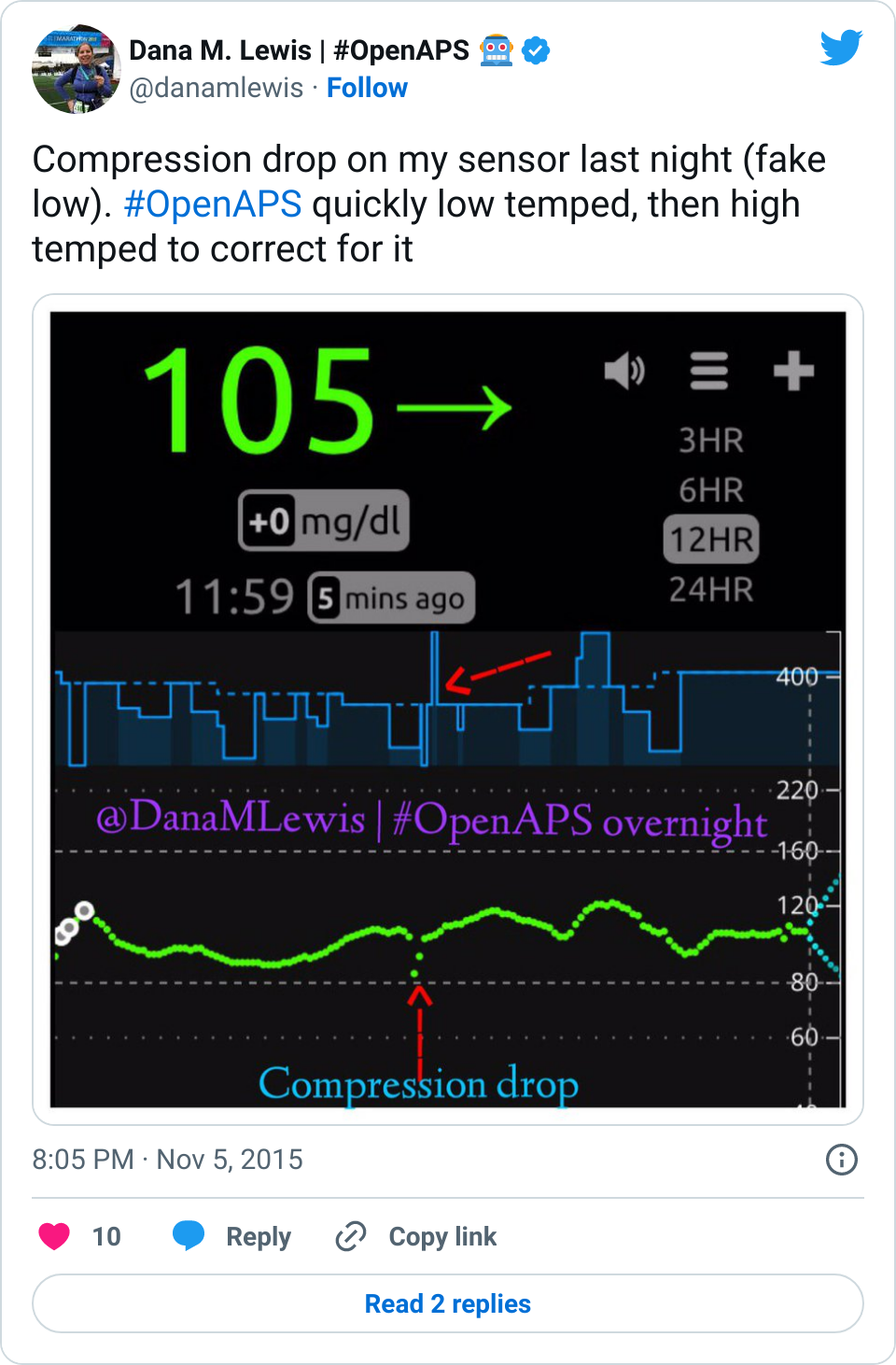 Showing a fake drop in CGM glucose data that is a compression drop