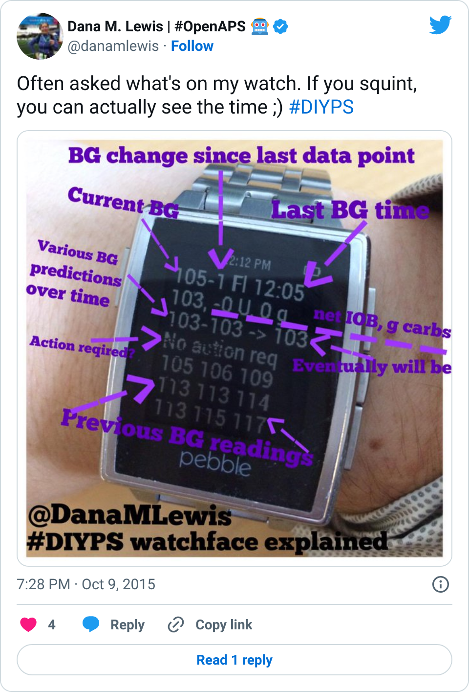 DIYPS watchface showing Dana M. Lewis's OpenAPS data