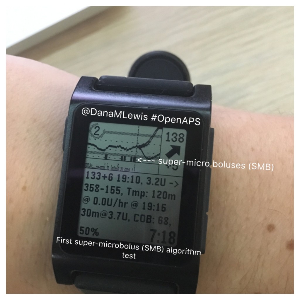 First oref1 SMB OpenAPS test as seen on @DanaMLewis pebble watch