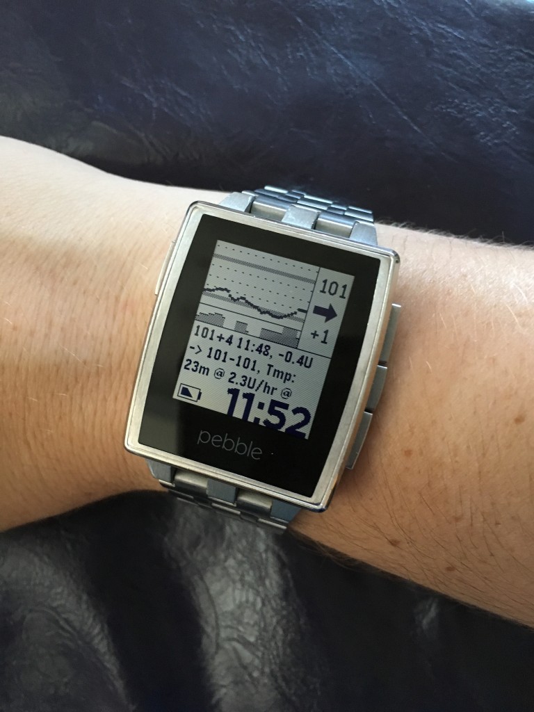 OpenAPS logs on Pebble watch @DanaMLewis example