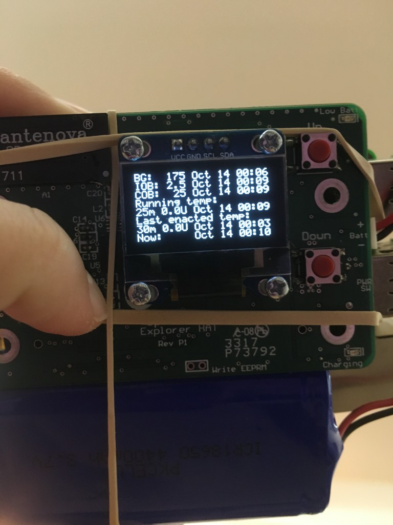 Pi_HAT_screen_OpenAPS_example_DanaMLewis