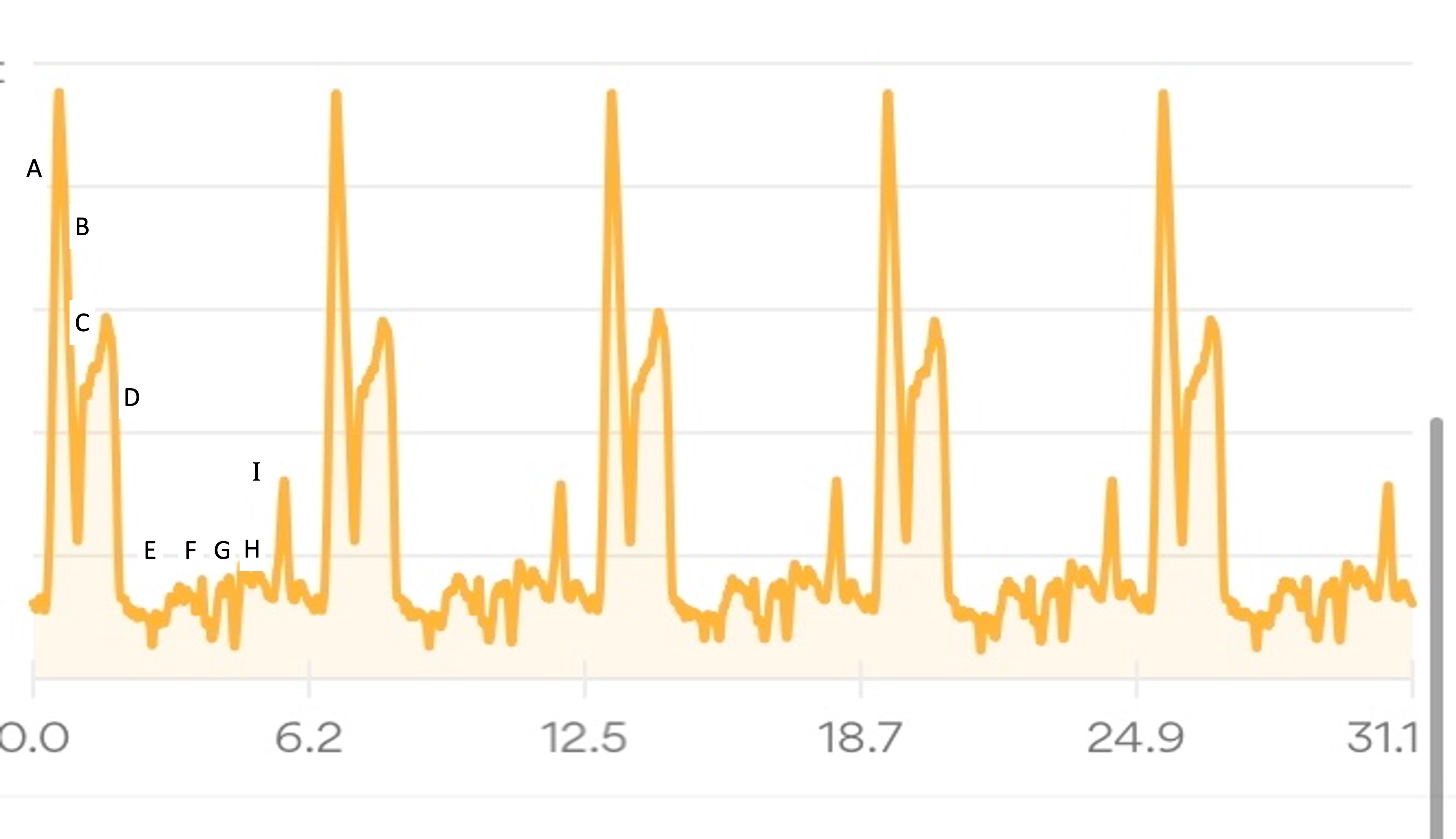 Runkeeper elevation profile of 5 loops on the Strawberry Fields Forever 50k course